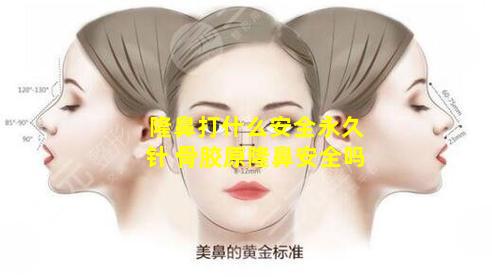 隆鼻打什么安全永久针 骨胶原隆鼻安全吗
